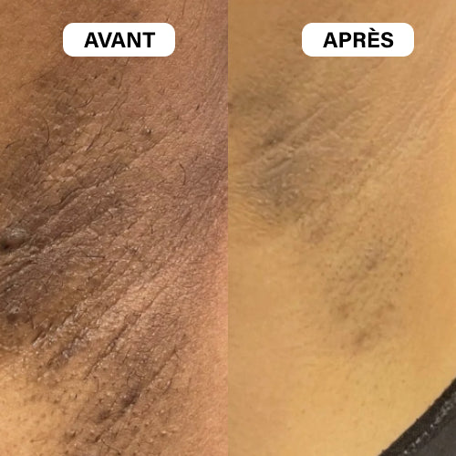 Savon noir