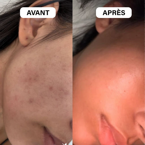 Huile d’argan